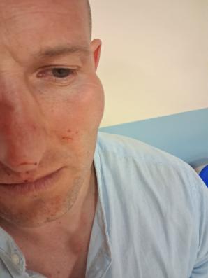 [VIDEO] Rutkowski na tropie byłych policjantów. Dariusz  Albrychowicz twierdzi, że został brutalnie pobity 